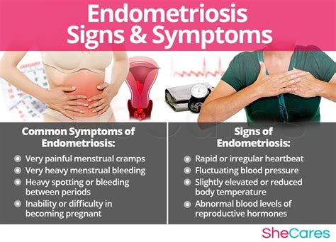 Endometriosis affects 1 in 10 women, often goes undiagnosed